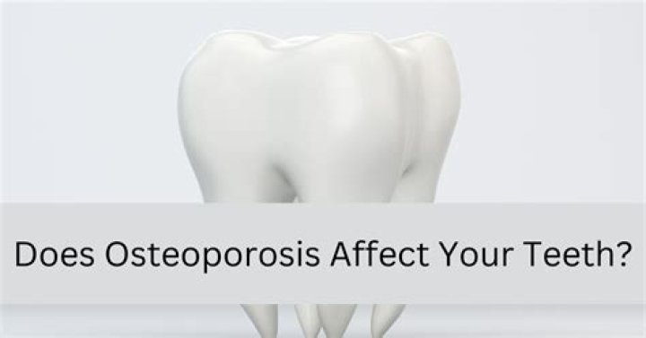 Does osteoporosis affect your teeth?