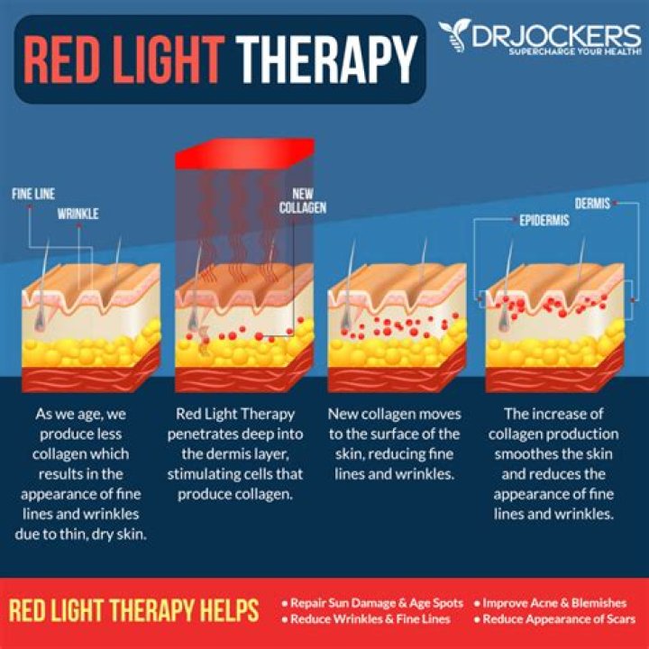 Does red light therapy work for stretch marks?