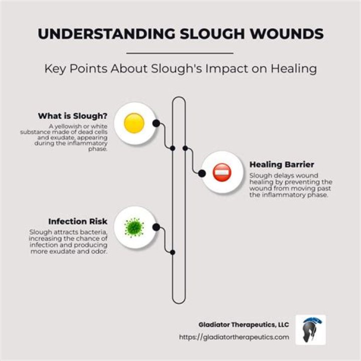 Does Slough mean infection?