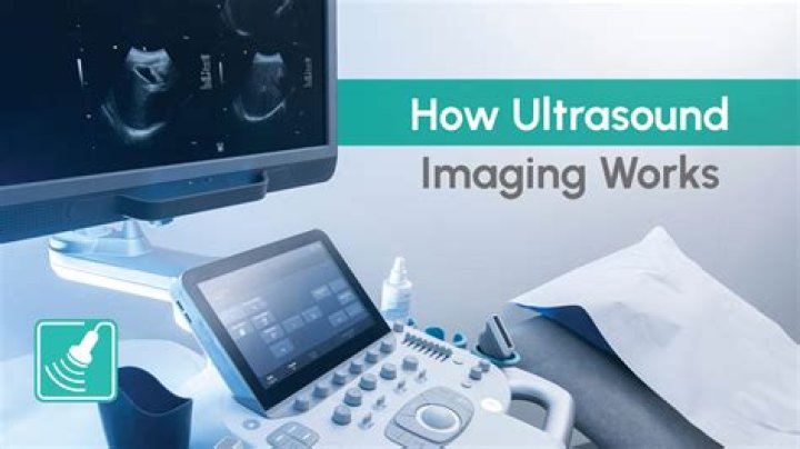 Does ultrasound have radiation?