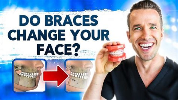 Does your nose change with braces?