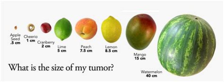 How big is a 4 cm tumor?