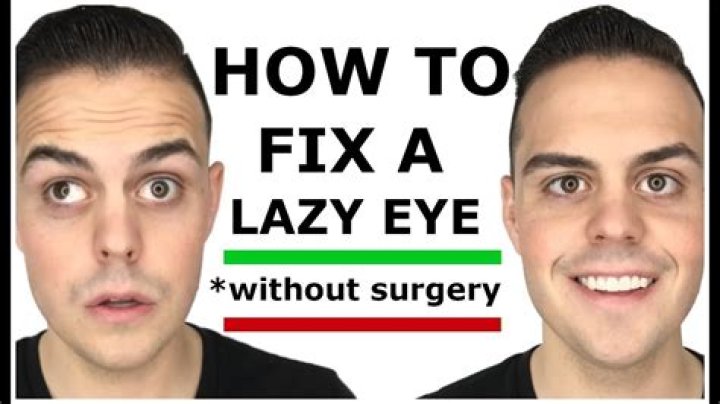 How can I fix my lazy eye?