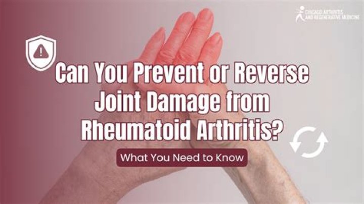 How can I reverse rheumatoid arthritis naturally?