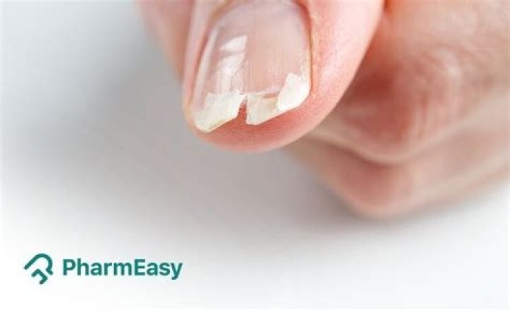 How can I stop my nails splitting vertically?