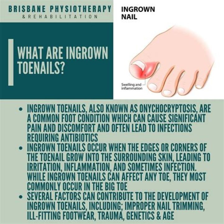 How do you deal with junctions?