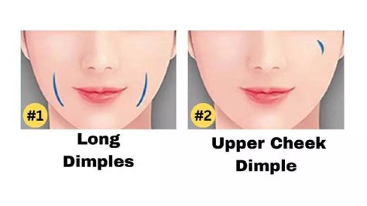 How do you fix dimples on your face?