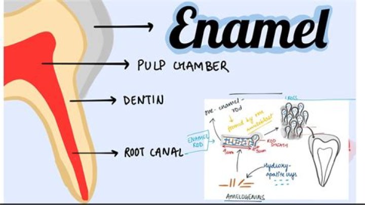 How do you know when enamel is gone?
