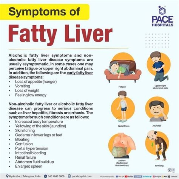 How do you live with a fatty liver?