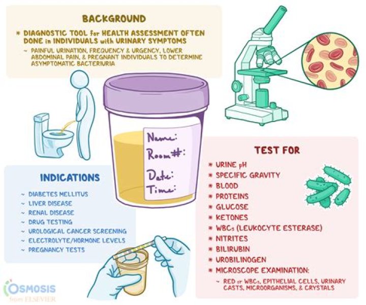 How do you pass a Delta 8 urine test?