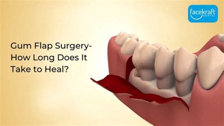 How do you tell if a gum flap is infected?