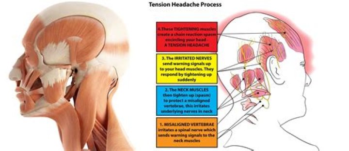 How do you treat chronic tension headaches?