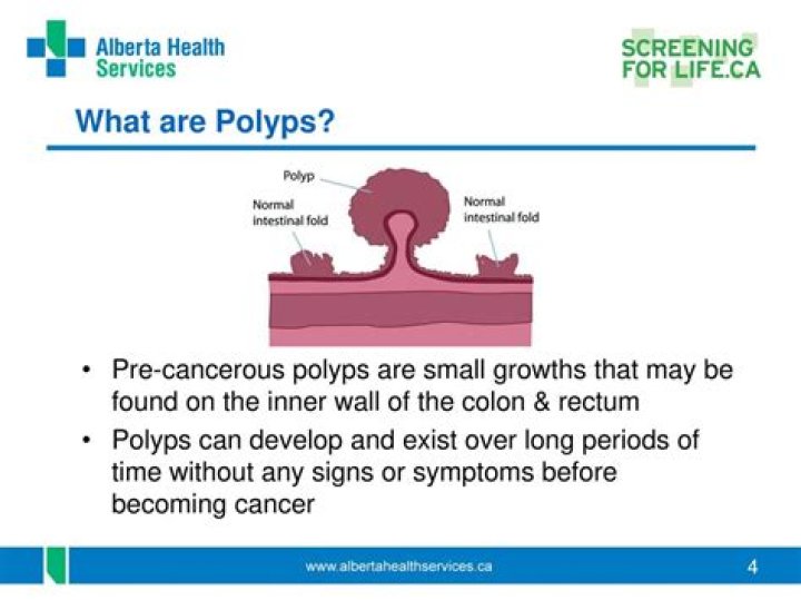 How long before a polyp turns cancerous?
