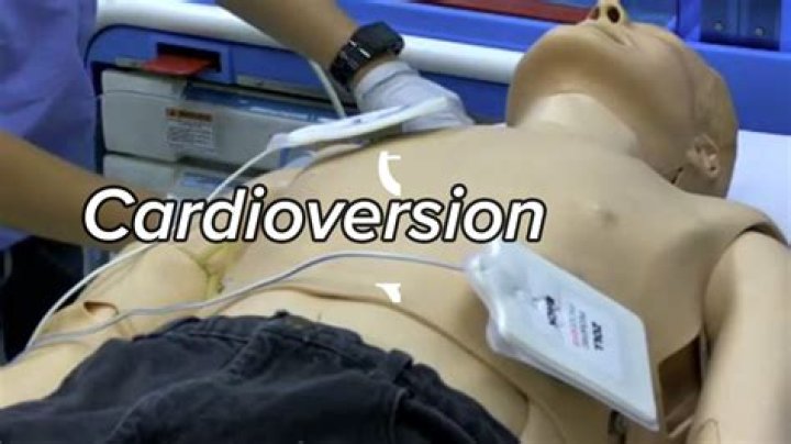 How long does a cardioversion take?