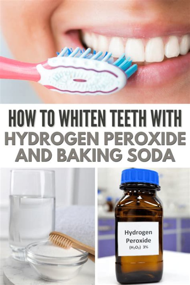 How long does hydrogen peroxide and baking soda take to whiten teeth?