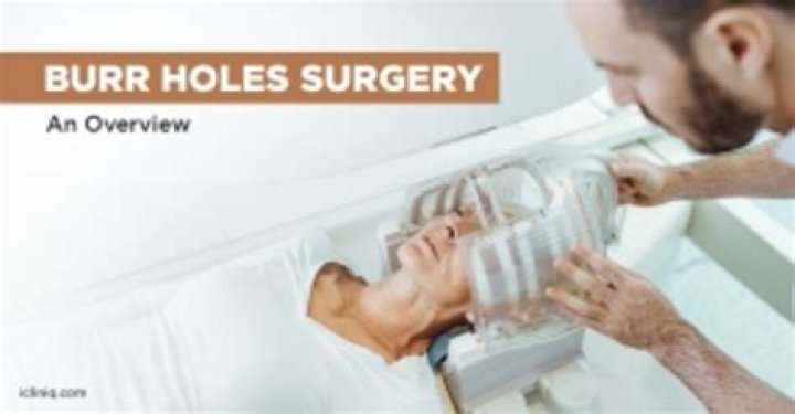 How long does it take to recover from burr hole surgery?