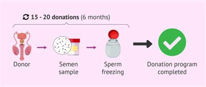 How much does it cost to buy sperm?
