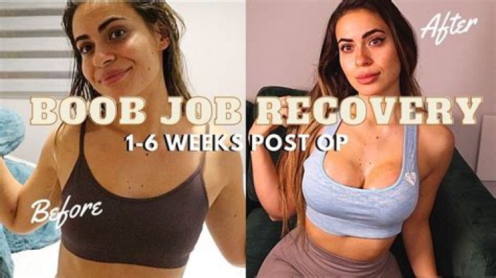 How painful is a boob job?