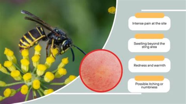 How painful is a yellow jacket sting?