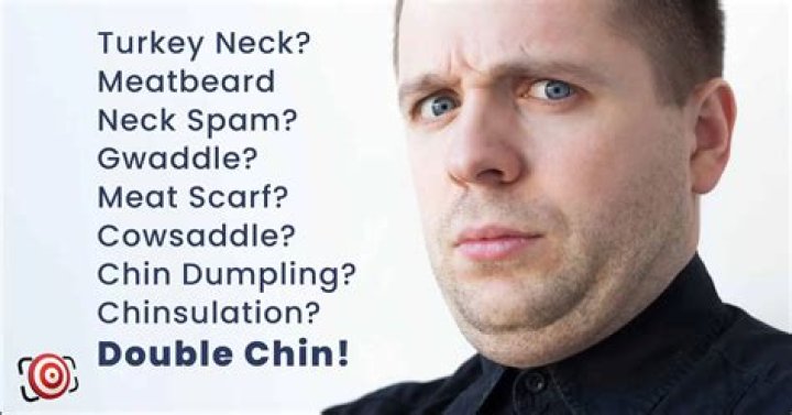 Is a small chin genetic?