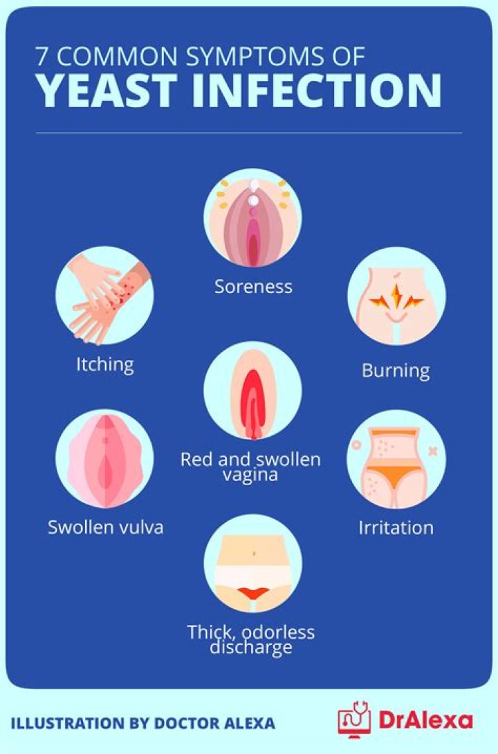 Is a yeast infection an STD?