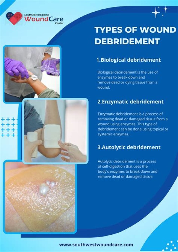 Is debridement an outpatient procedure?
