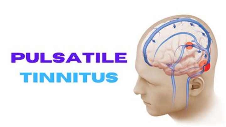 Is habituation to tinnitus real?