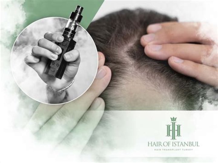 Is hair loss from vaping permanent?