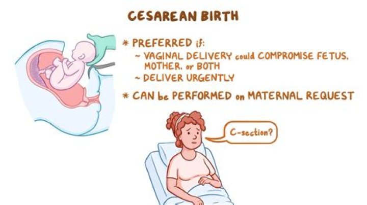 Is it harder to get pregnant after C-section?