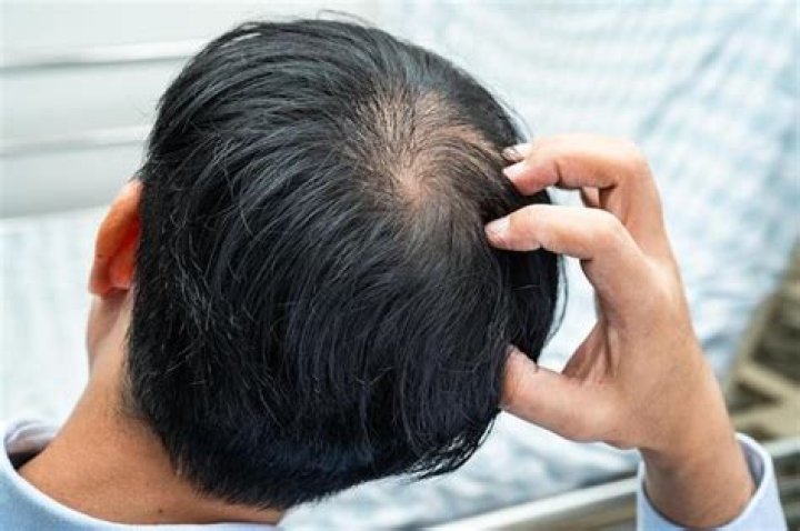 Is losing 200 hairs a day normal?