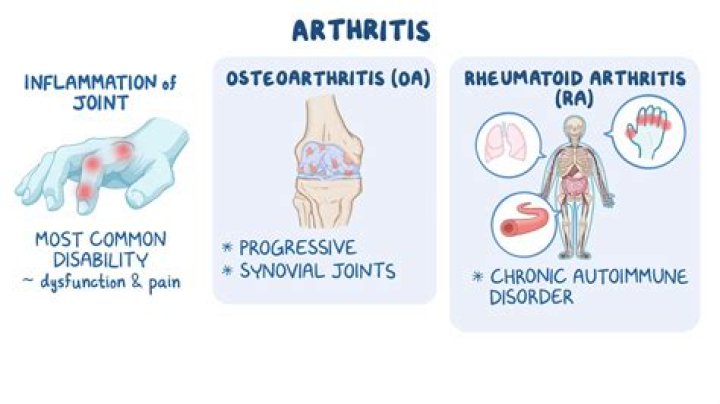 Is osteoarthritis and rheumatoid arthritis hereditary?