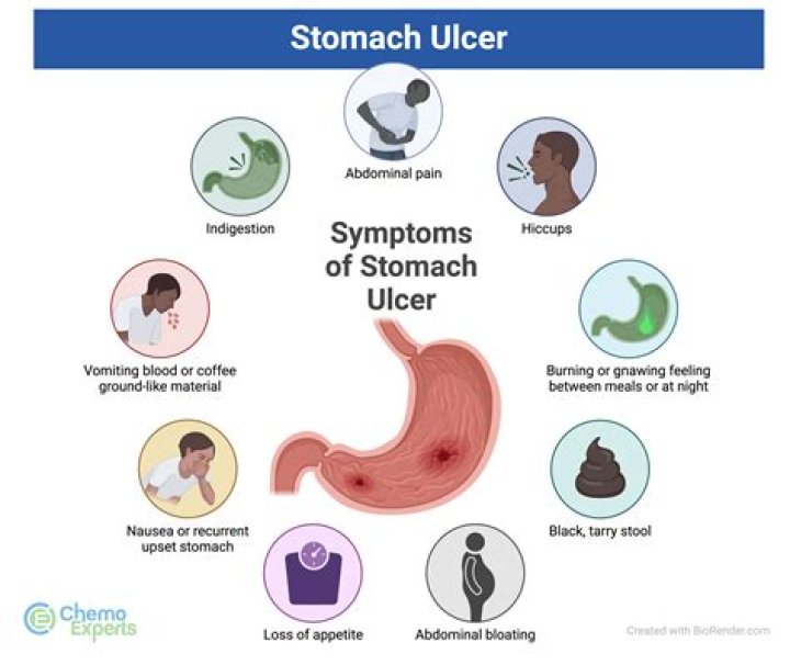 Is rice good for ulcers?