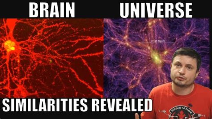 Is universe a brain?