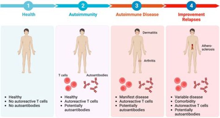 Is vertigo an autoimmune disease?