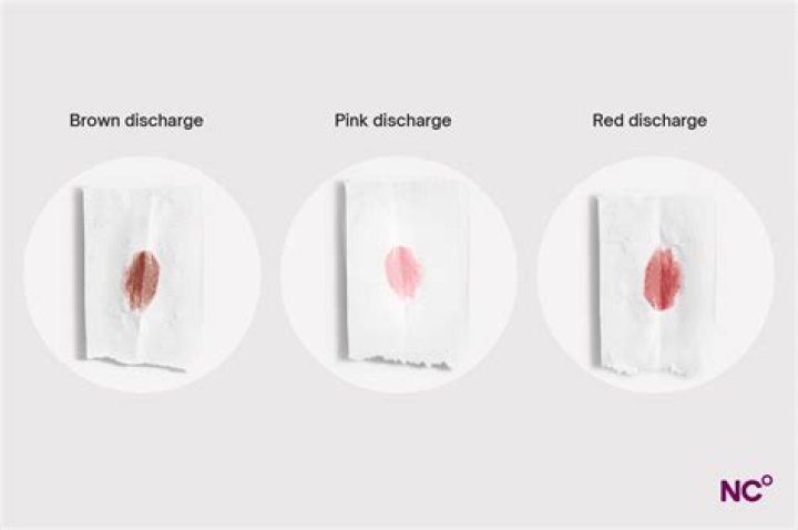 Should I be worried about brown discharge?