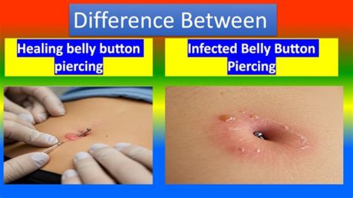 Should I let my daughter get a belly button piercing?