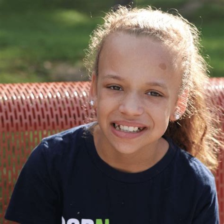 Should I worry about café-au-lait spots?