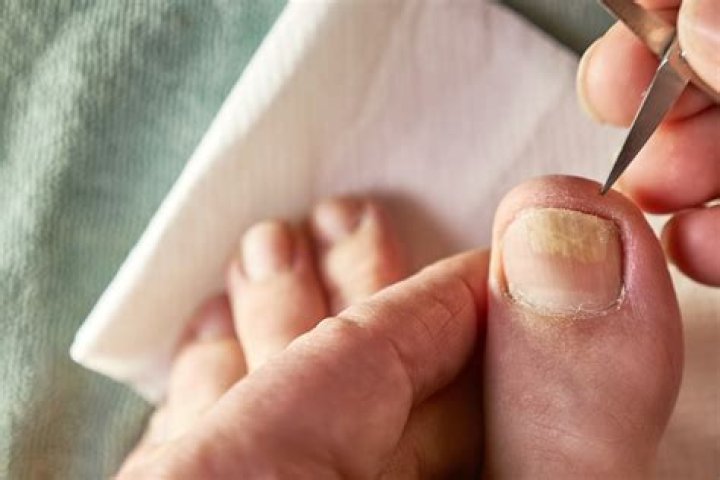 Should you cut toenails wet or dry?