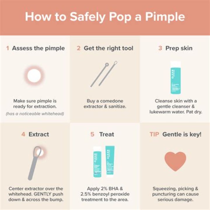 Should you pop a pimple if it has a white head?