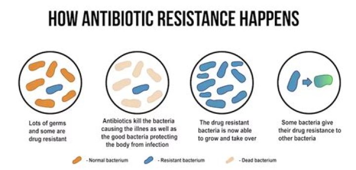 What antibiotic kills TB?