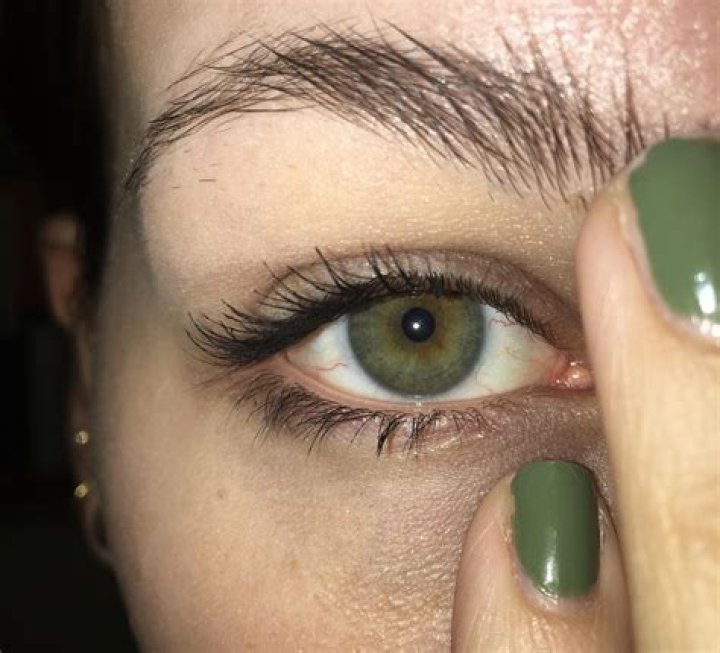 What are green eyes caused by?
