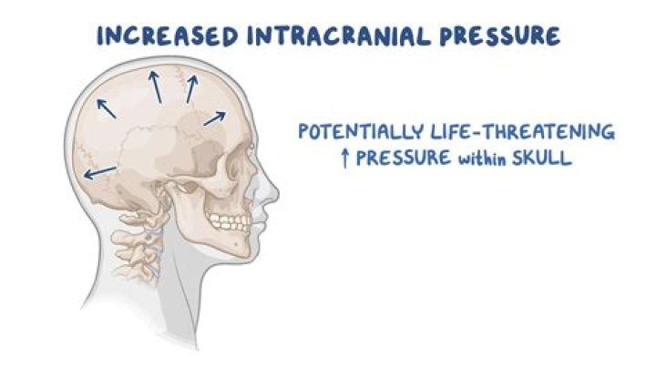 What are late signs of increased intracranial pressure?