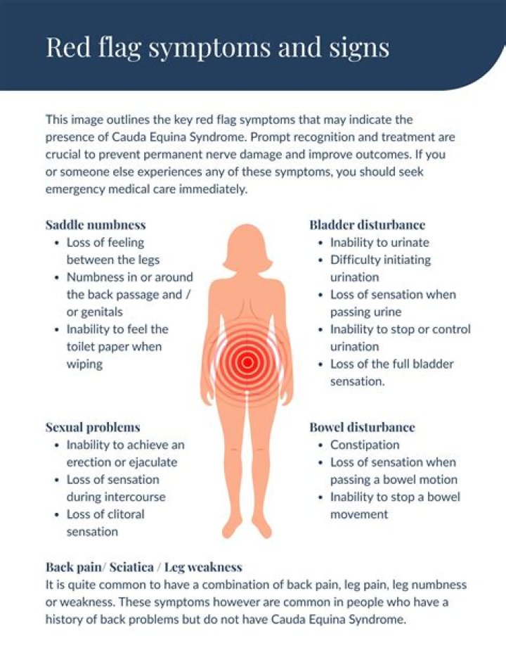 What are red flags for cauda equina?