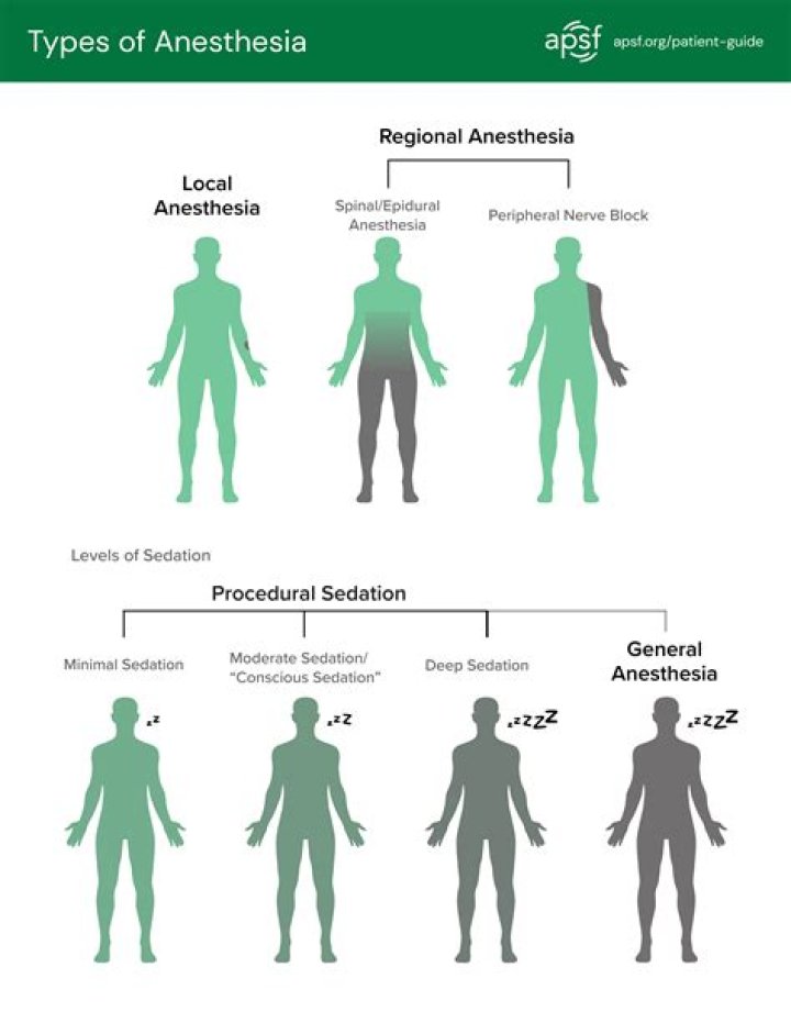 What are the 6 types of anesthesia?