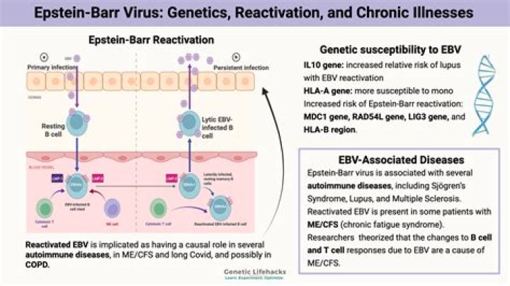 What are the symptoms of chronic Epstein-Barr?