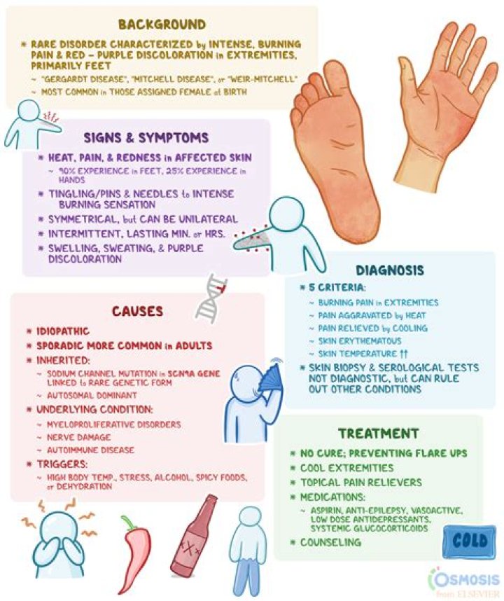 What autoimmune disease causes tingling in hands and feet?
