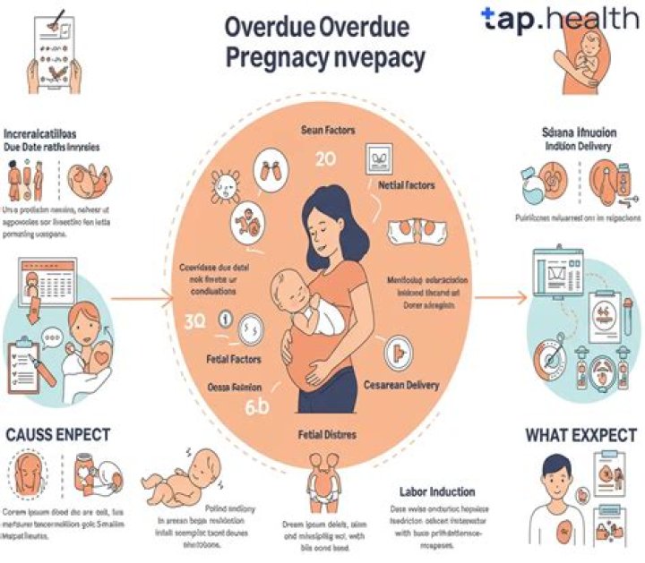 What causes baby overdue?