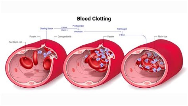 What causes blood to thin out?