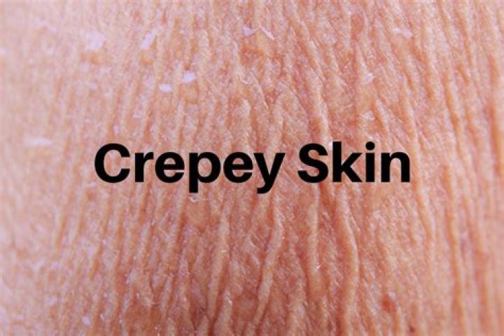 What causes Crepey skin on upper arms?