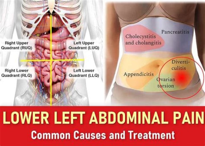 What causes pain in lower abdomen and back?